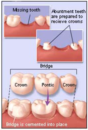 charlotte laser dentist