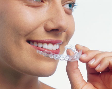 Invisalign Dentist Charlotte NC