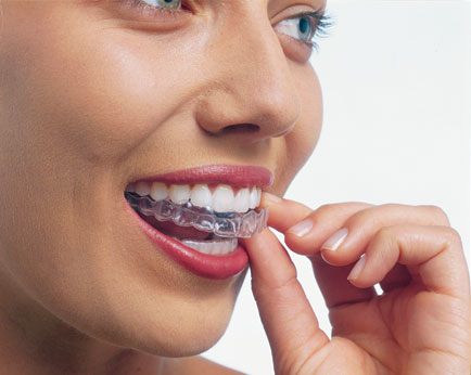Invisalign Dentist in Charlotte NC McMurtry