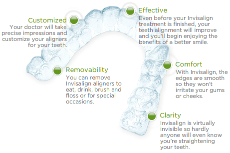 Invisalign Dentist charlotte