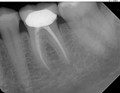 Emergency Dental Charlotte NC: Schedule an appointment with Dr Brian McMurtry today