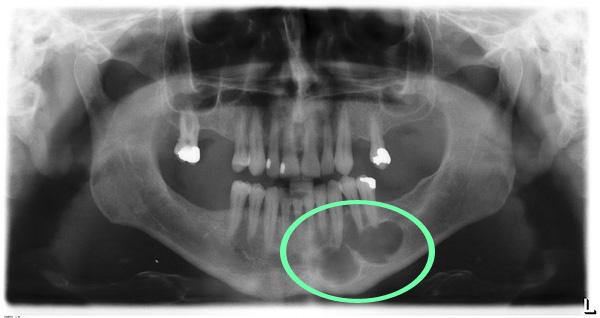 Dr. Brian McMurtry will help you with your Charlotte dental emergency needs