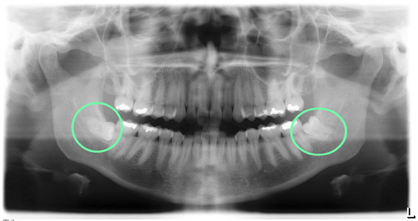 For your Charlotte emergency dental needs, visit Dr. Brian McMurtry